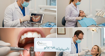 تصویربرداری قبل از ایمپلنت دندان چیست؟ نقش CBCT و پانورکس در موفقیت کاشت ایمپلنت | فردپرتو تهران