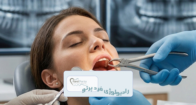 چرا قبل از کشیدن دندان عکس لازم است؟ پانورکس و CBCT | فردپرتو